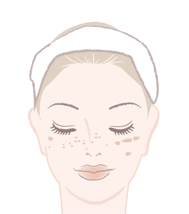 シミ・そばかす